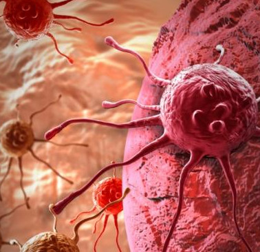 New method of destroying colorectal cancer cells