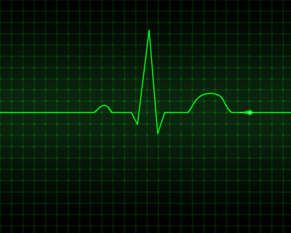 New method of treating arrhythmias