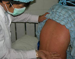 New method to detect fetal rubella infection