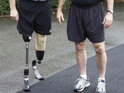 New method to help diabetics avoid getting limb!
