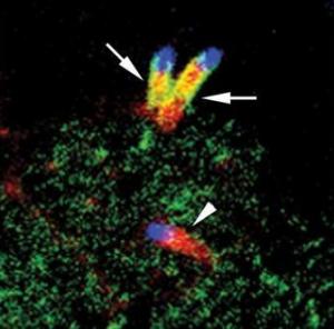 New mode of spread of deadly bacteria in food