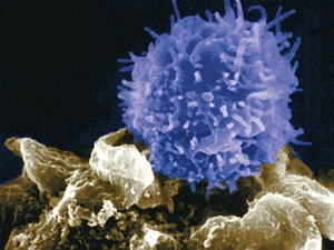 New prospects for developing anti-cancer vaccines