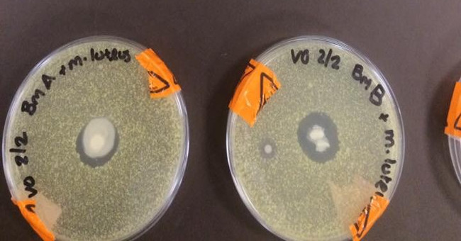 New research: Breast milk is capable of killing all types of bacteria
