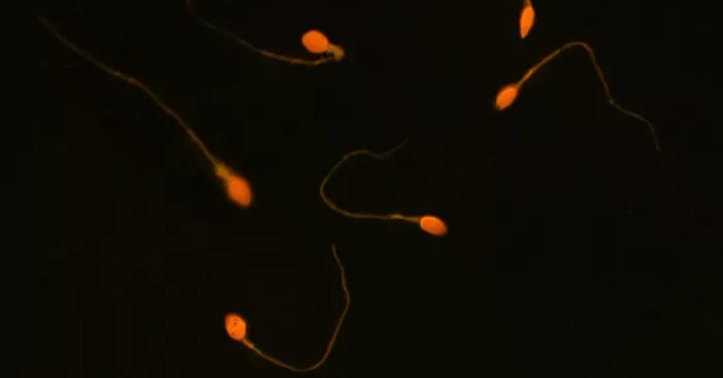 New research on contraceptives for both men and women cures infertility in men