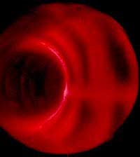New solution for fusion reactor