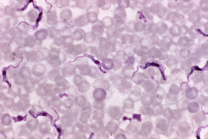 New technique to help learn about African sleeping sickness