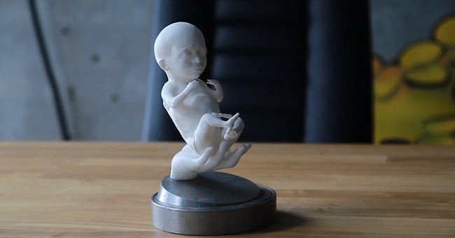 New technology to help parents get 3D model of fetus