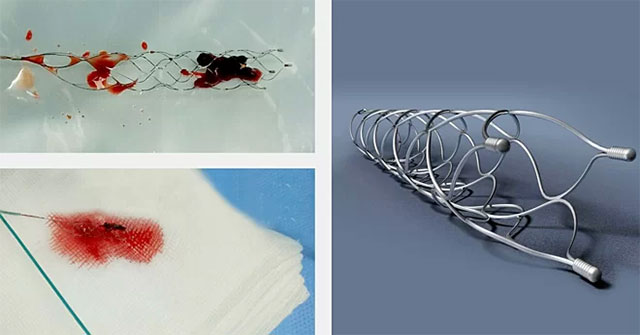 New technology to save stroke people