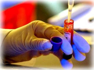 New tests help diagnose liver cancer early