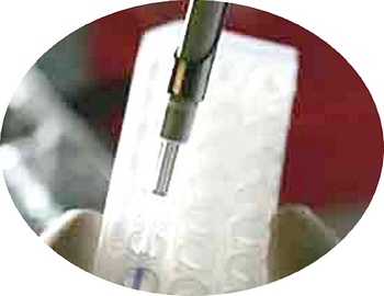 New tool to diagnose prostate cancer