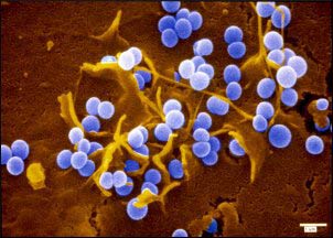 New vaccines can fight common infections