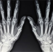 New X-rays penetrate