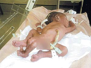 Newborn baby 4 feet