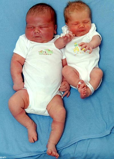 Newborn baby weighs nearly 7 kg