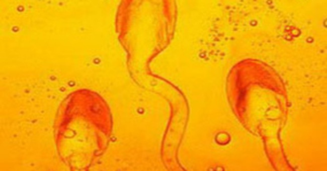 Normal indicators when evaluating a semen test