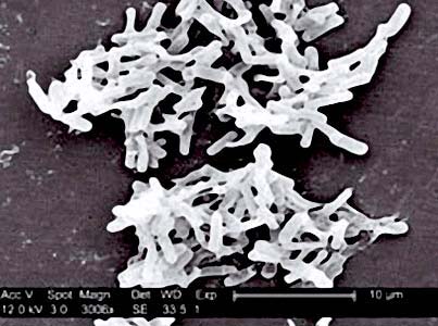 North American enteritis occurs in Japan