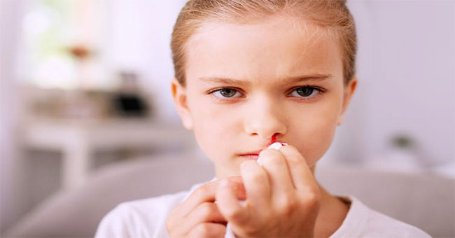 Nosebleed - what should be noted?