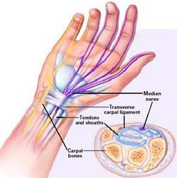 Numbness: Watch out for muscle atrophy