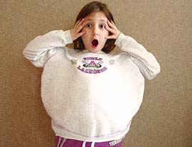 Obese children are the most difficult to treat