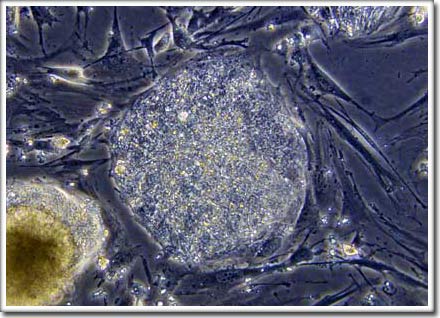 One more step towards stem cells