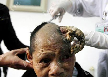 One more woman grows horns in China
