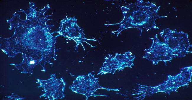 Only with this technology, cancer cells will