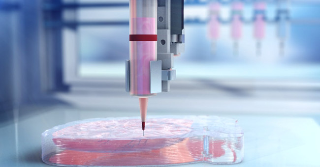 Organ transplantation ... 3D printing