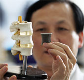 Organ transplants with 3D printing technology