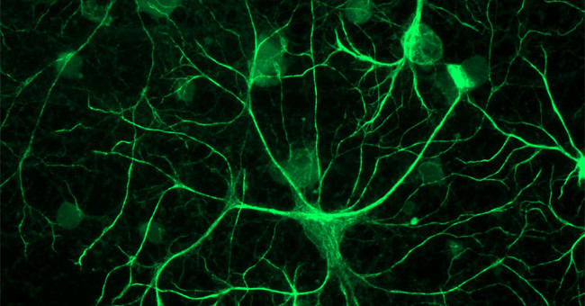 Our brains tend to predict the future, do you realize that?