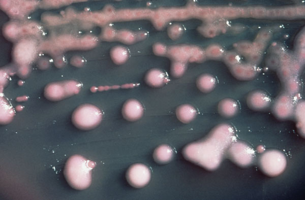 Outbreaks of new viruses resistant to drugs