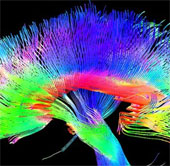 Painters have a different brain structure than ordinary people