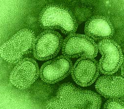 Pandemic & infectious diseases in human history