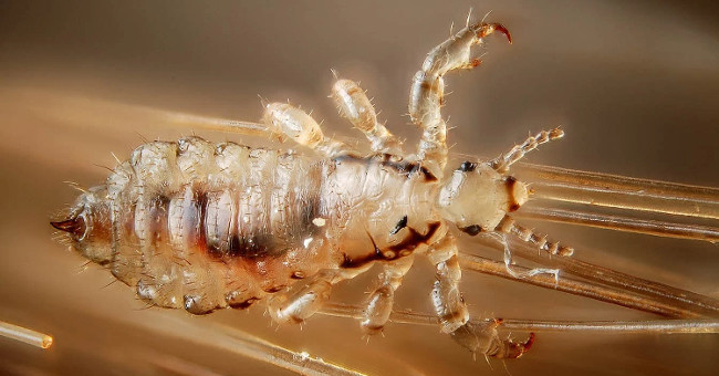 Pandemic hair is about to explode when 98% of lice are resistant