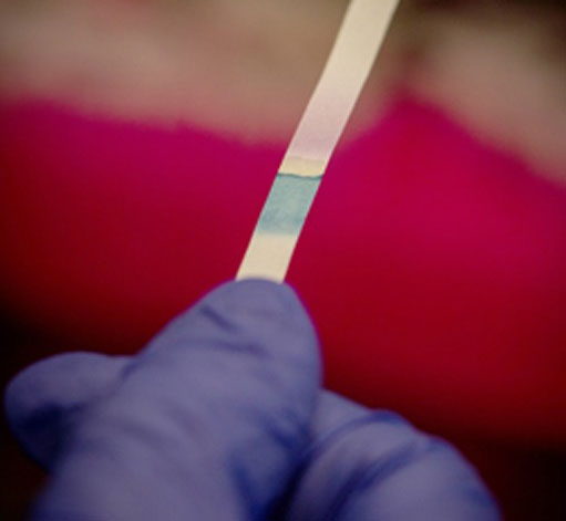Paper tape detects E. coli