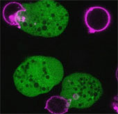 Parasitic amoeba kills cells by grabbing each plate
