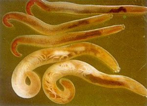 Parasitic meningitis spreads through food