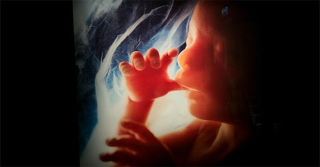 Particles polluting the air 'squeeze' into the placenta?