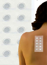 Patch Test: Test for allergies
