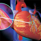 People have been suffering from heart disease since 4,000 years ago