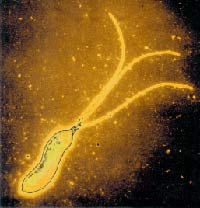 People have had stomach ulcers since prehistoric times