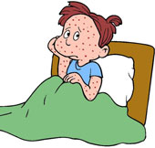 People with chickenpox in Hanoi suddenly increased