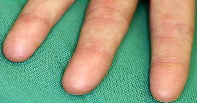 People with strange abilities due to ... genetic errors