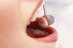 Periodontal diseases in children