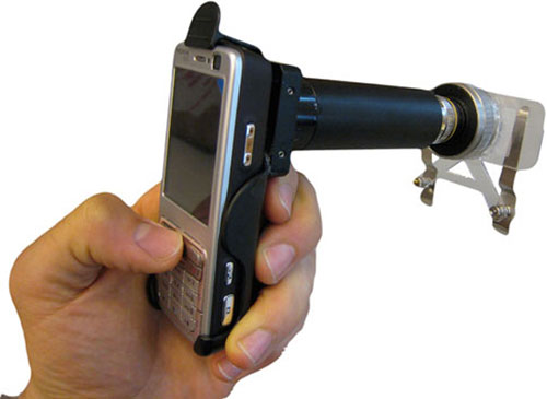 Phone microscope recognizes disease characteristics