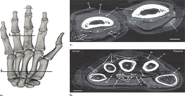 Photography techniques reveal every blood vessel inside the mummy