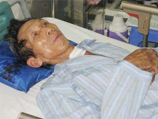 Pig streptococcal disease: Very easily transmitted through humans