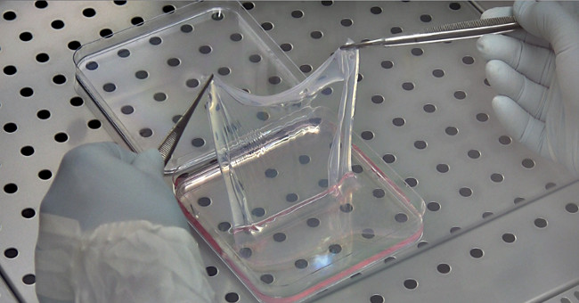 'Planting' ... human skin in the laboratory