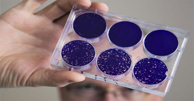 Polio virus offers hope for curing brain cancer