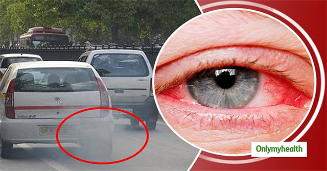 Pollution caused by vehicle smoke: The leading cause of eye diseases