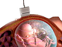 Pregnancy malnutrition is difficult to diagnose